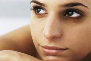 A woman with dark eye circles