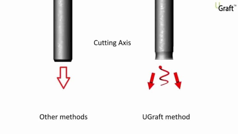 The Dr.UGraft ™ technology can repair bad hair transplant results through a uniquely designed flared hybrid punch that cuts away from follicles. This makes it easier for surgeons to safely remove a greater number of healthy grafts from both the head and body regions to perform a successful hair transplant reparative surgery.