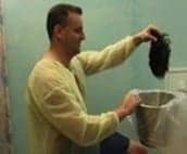 Dr U patient disposing hairpiece after treatment using Dr UGraft