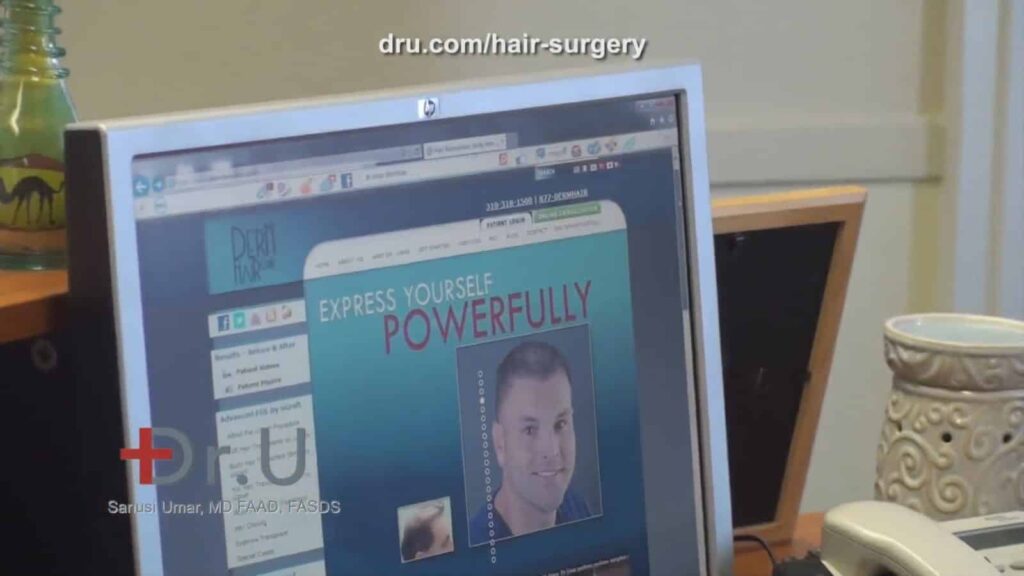 Understanding Hair Transplant Surgery Through Research