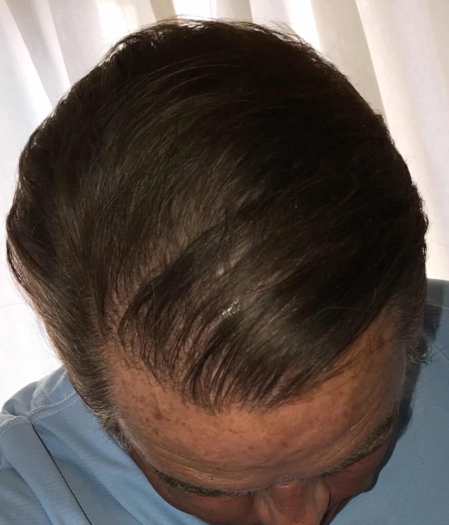 This patient felt great about his results after treatment.