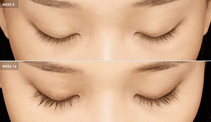 16 weeks of Latisse eyelash treatment 