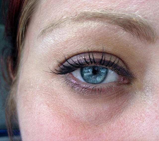 Reducing Puffiness and Under Eye Bags