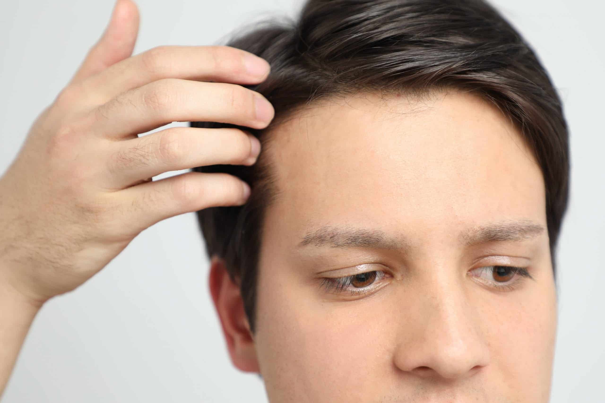 A male hairpiece may look convincing. But it's difficult to know when socially awkward clues and dead-giveaways may arise