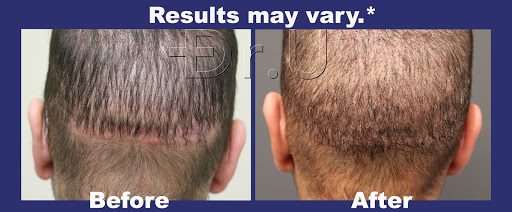 Before and after picture of the patient. Before and after picture of the patient.