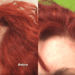 Tension hair loss affects women of all ethnic groups since tight ponytails and harsh grooming habits can contribute to thinning.*