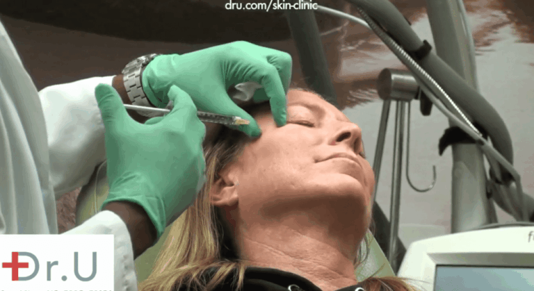 Dr. Umar's patient receiving Botox treatment as a crows feet treatment and to address other concerns like frown lines, forehead wrinkles and droopy eyebrows Dr. Umar's patient receiving Botox treatment as a crows feet treatment and to address other concerns like frown lines, forehead wrinkles and droopy eyebrows