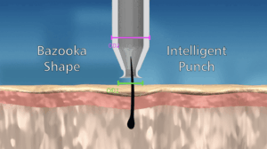 Intelligent Hair Punch