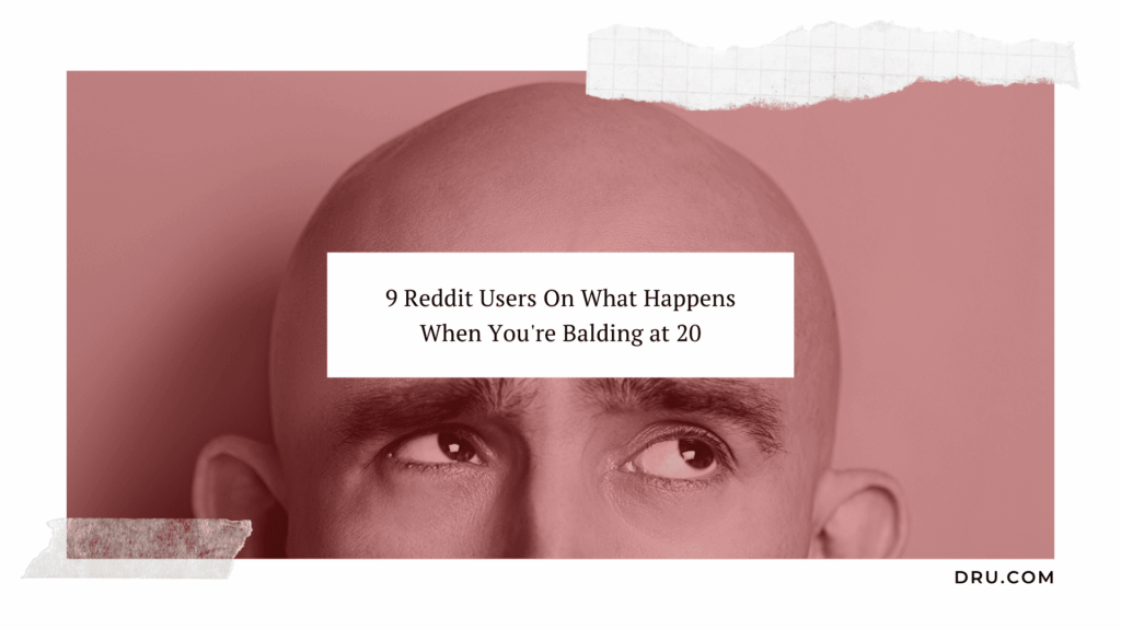 Balding at 20 - Redditors and their experiences Balding at 20 - Redditors and their experiences