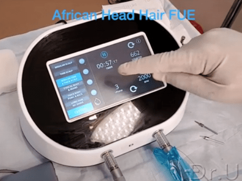 The Dr.UGraft Zeus console offers a touch-screen interface and presets based on skin thickness types across all ethnic groups The Dr.UGraft Zeus console offers a touch-screen interface and presets based on skin thickness types across all ethnic groups