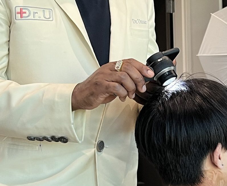 Dr. U performing a trichoscopy. A trichoscopy can be done to diagnose whether or not a patient has LPP, CCCA, FFA, or other types of primary cicatricial alopecia (scarring alopecia).*