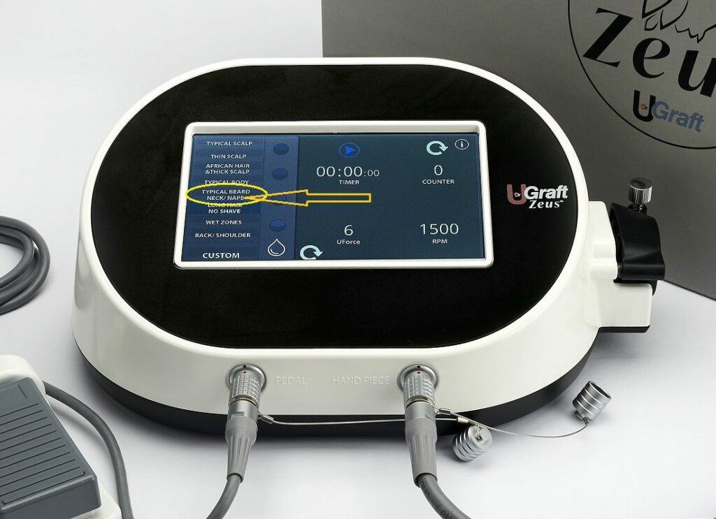 Nape Hair Extraction Setting in UGraft Zeus