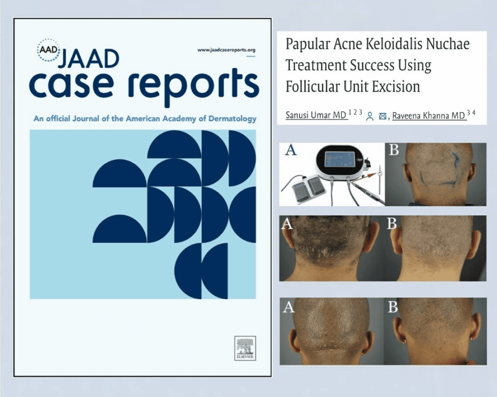 The groundbreaking study was published in the JAAD Case Reports journal.