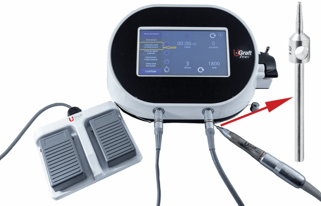 The UGraft Zeus device showing a handpiece, foot pedal, and a console with a dashboard highlighting (yellow) the thick-firm scalp preset selection and the torque (UForce) and rotational speed (RPM) dials. Inset shows a closer view of the punch (Red arrow). RPM, Revolution per minute.