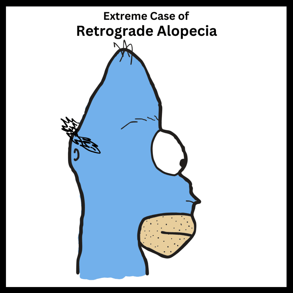 A cartoon character who has a severe case of retrograde alopecia. A cartoon character who has a severe case of retrograde alopecia.