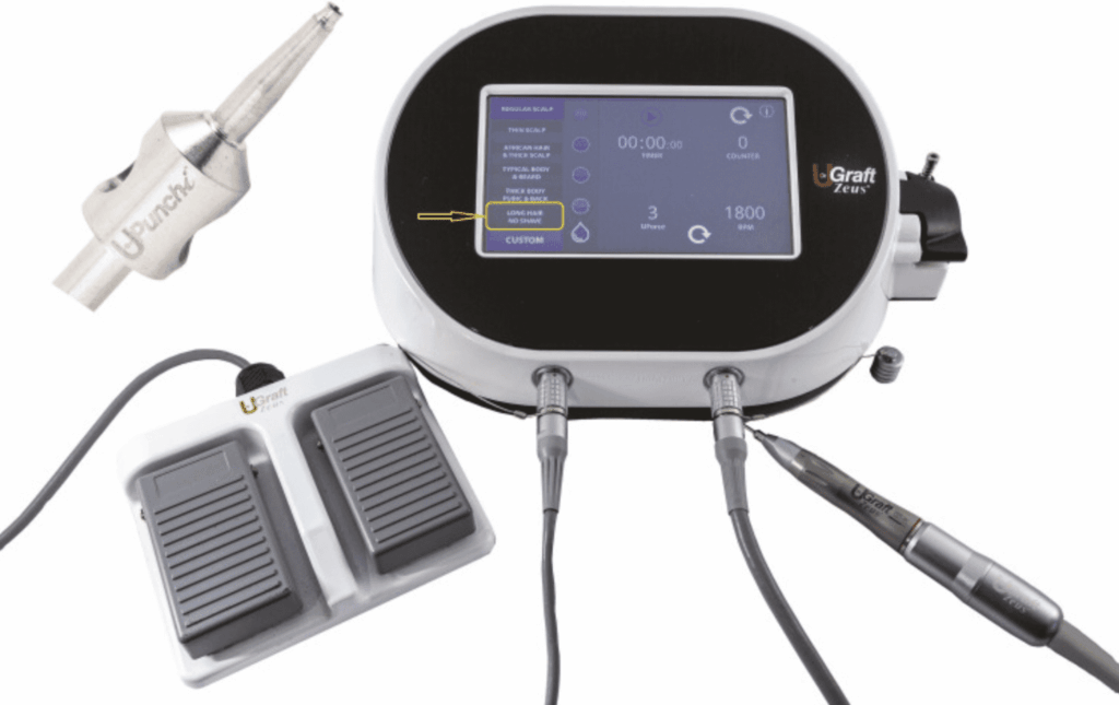 The UGraft Zeus is an all-purpose FUE technology that allows for a seamless and successful no-shave long hair FUE hair transplantation. The UGraft Zeus is an all-purpose FUE technology that allows for a seamless and successful no-shave long hair FUE hair transplantation.