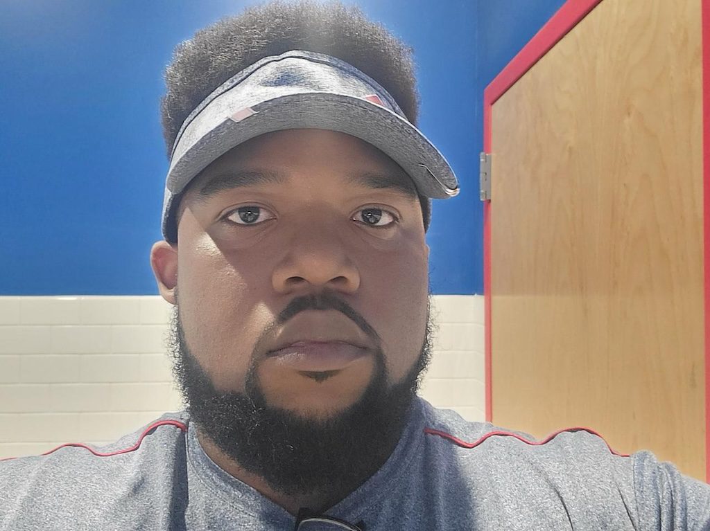 Adrian in his work uniform, showing how he worked hard to afford AKN removal surgery.