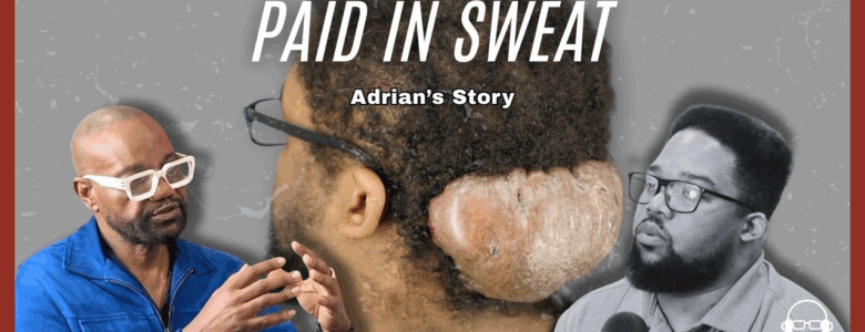Paid In Sweat: The Sacrifices Adrian Made To Get AKN Removal Surgery