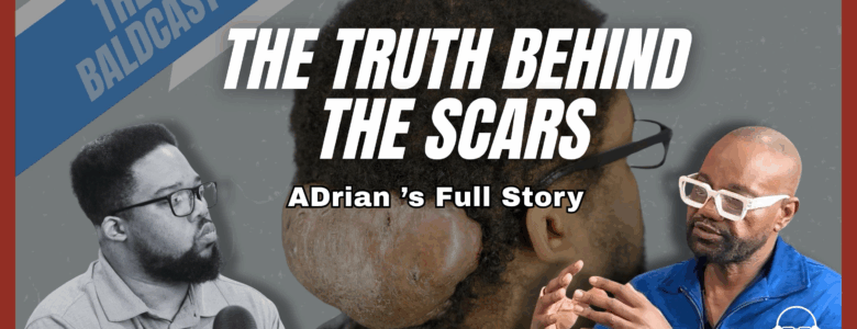From Hidden Scars to Hair Peace: Adrian’s 8-Year Battle With Acne Keloidalis Nuchae