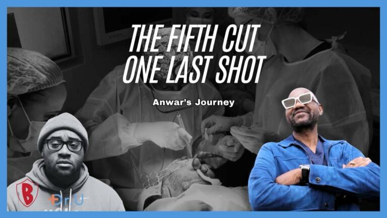 Fifth Cut, One Last Shot: Navigating Through a Challenging Folliculitis Decalvans Surgical Landscape