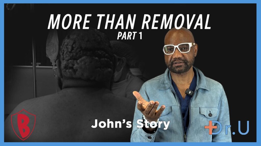 More Than the Removal of Posterior Scalp Scarring Disorder
