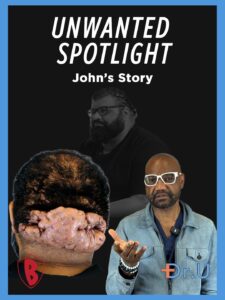 unwanted spotlight