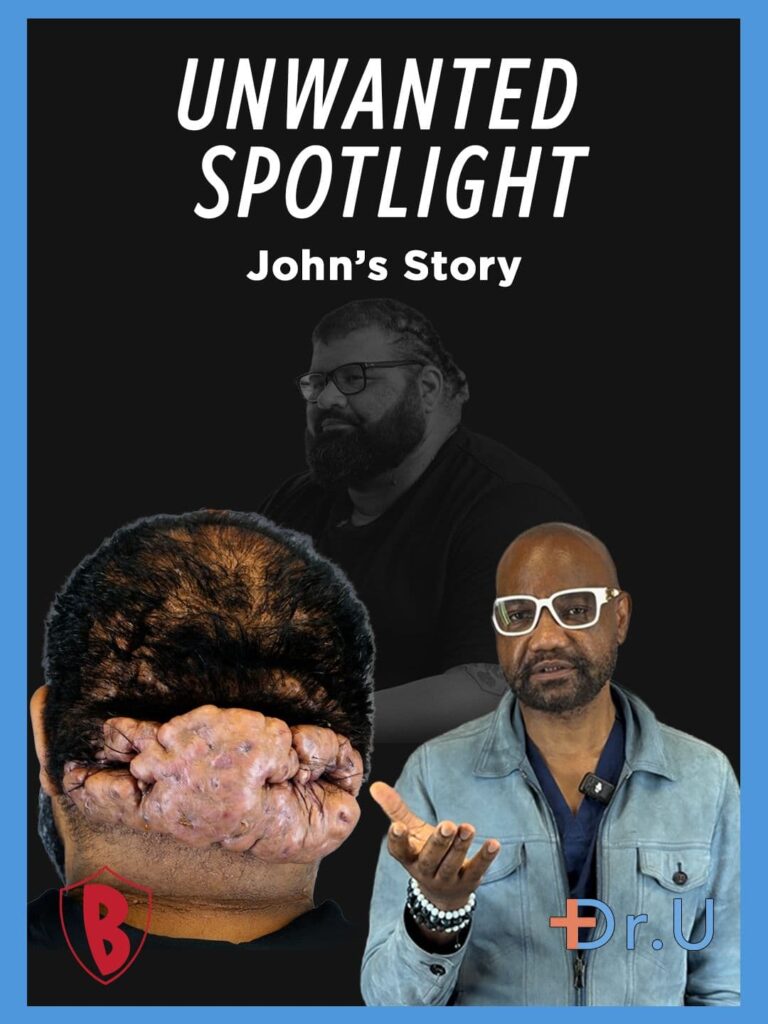 unwanted spotlight