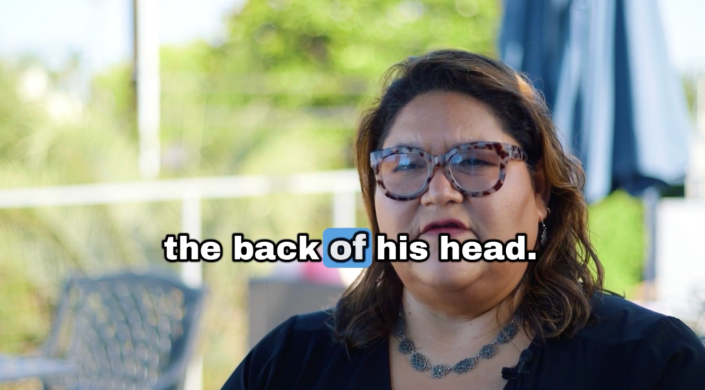 Cheyenne, John’s sister, mentions that the scalp bumps started when he was a teenager, and their family is very happy that he is now receiving the right help for his needs.

