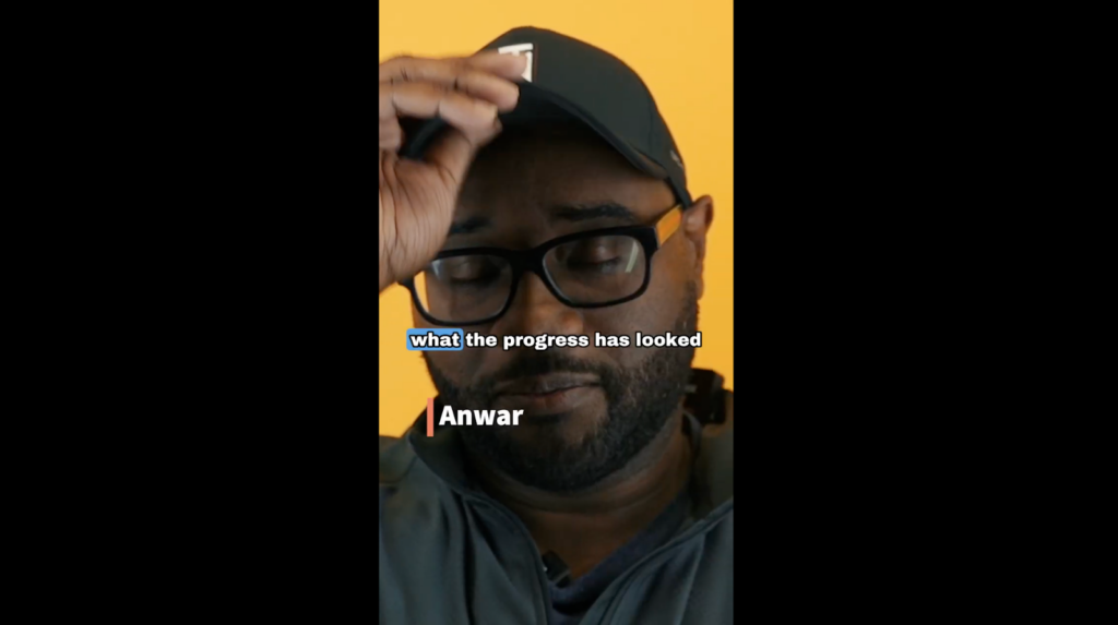 Anwar’s scalp bumps were removed and he is now healed after the surgery. Now, he is ready to show the excellent progress of his now healthy scalp.