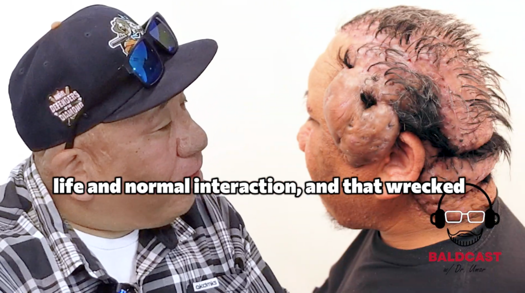 Like most men, Robert longs to have a normal life such as getting married and having kids. But due to his condition, social interaction is a very difficult thing to accomplish.