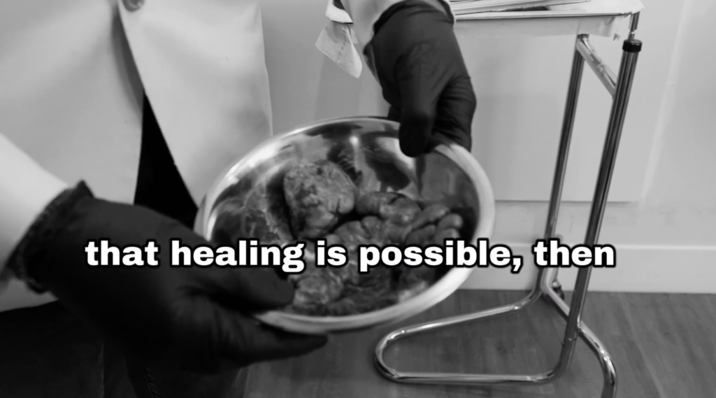 Anwar mentions how important it is to believe that healing beyond experiencing scalp issues for years – is still possible