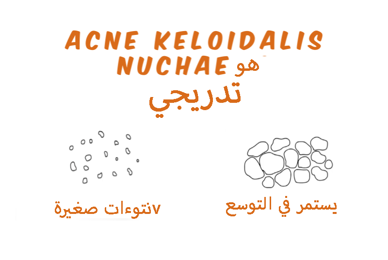 AKN Bumps Grow and Fuse Together - Graphic Image Detailing Acne Keloidalis Nuchae Progression.