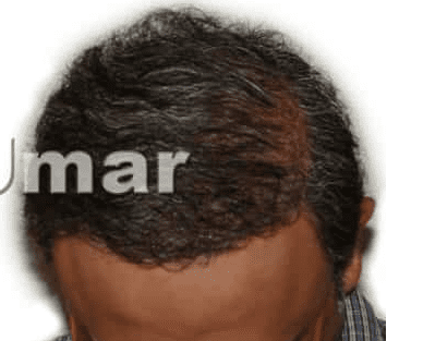 After image
