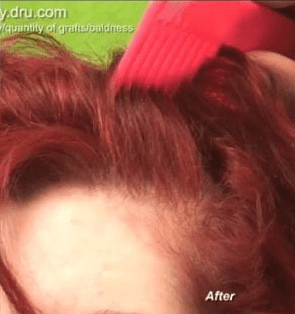 After image