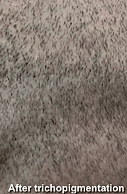 After image
